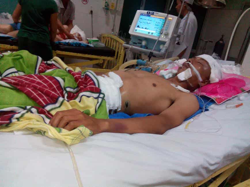 Khởi tố vụ án đánh người dẫn đến chấn thương sọ não - 第1张 - Chư Sê 24h Khởi tố vụ án đánh người dẫn đến chấn thương sọ não - 第1张