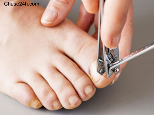 Bí quyết chăm sóc da chân tự tin đi sandal ngày hè - 第2张