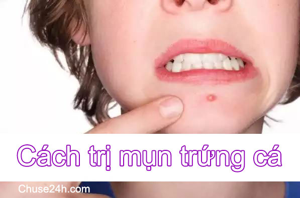 Cách trị mụn trứng cá từ thiên nhiên - 第1张