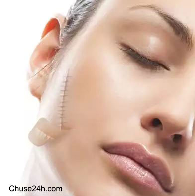 Làm thế nào để hết sẹo? - 第1张